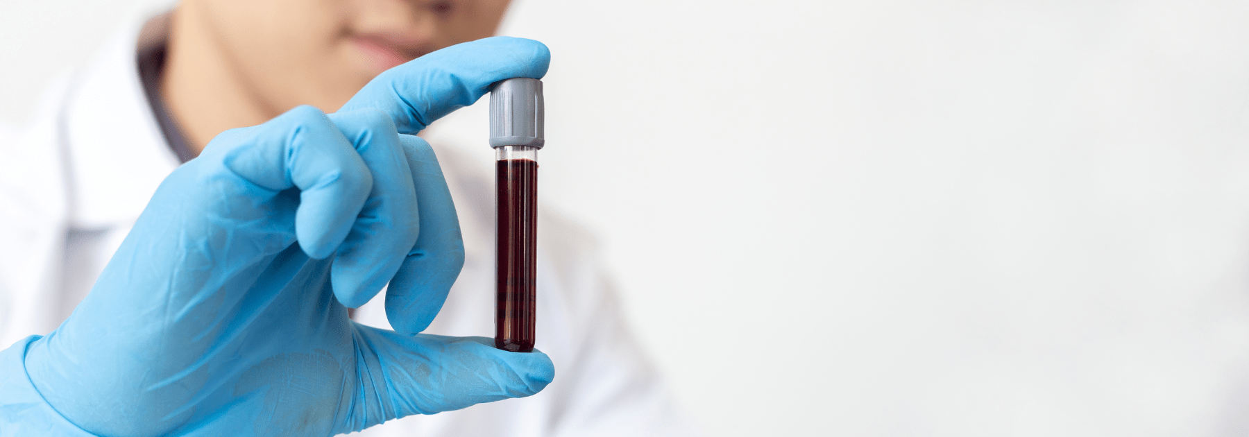 Private blood tests in Edinburgh